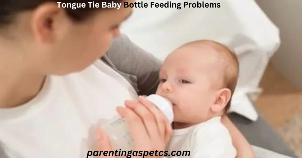Tongue Tie Baby Bottle Feeding